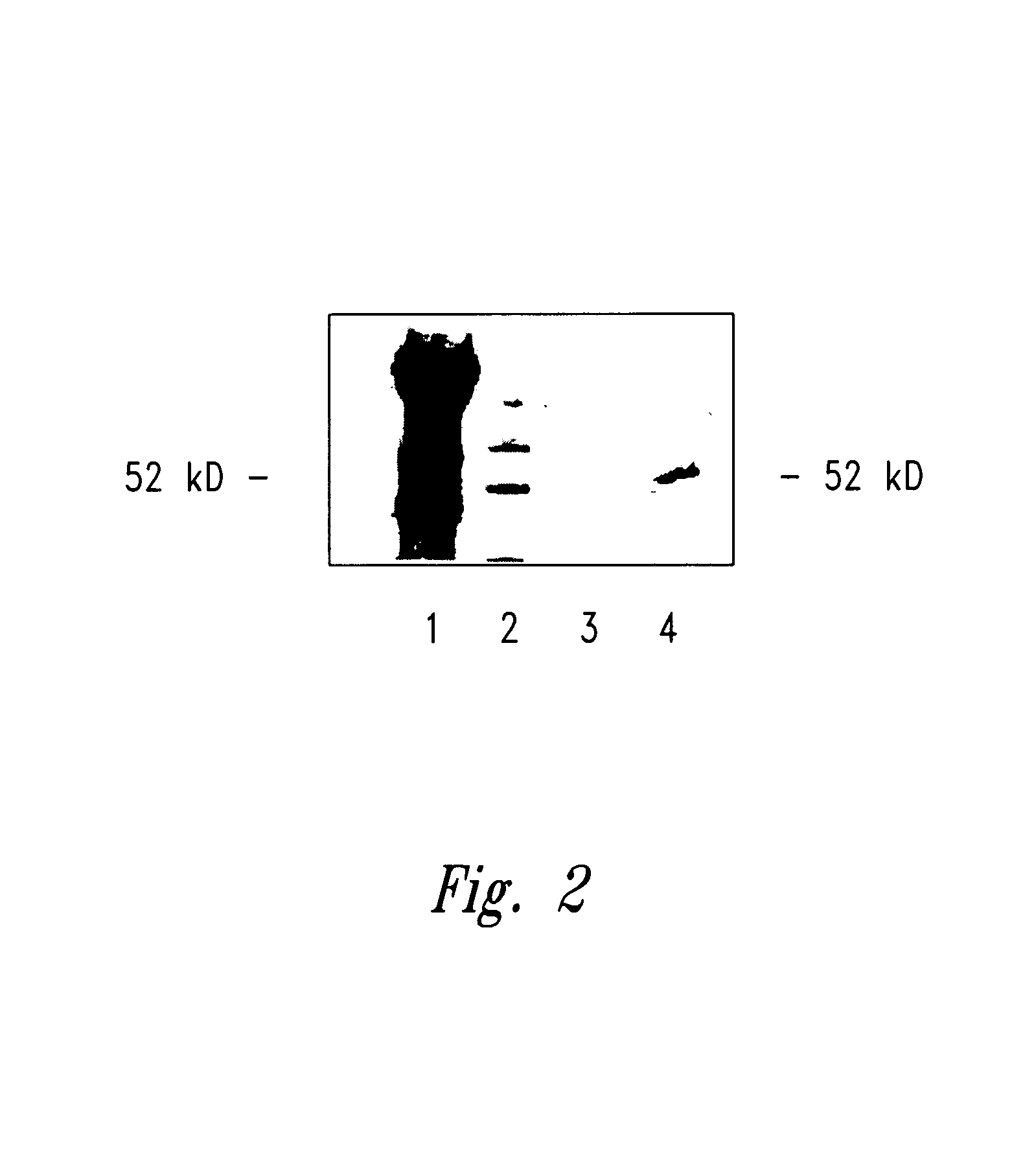 Compositions and methods for WT1 specific immunotherapy