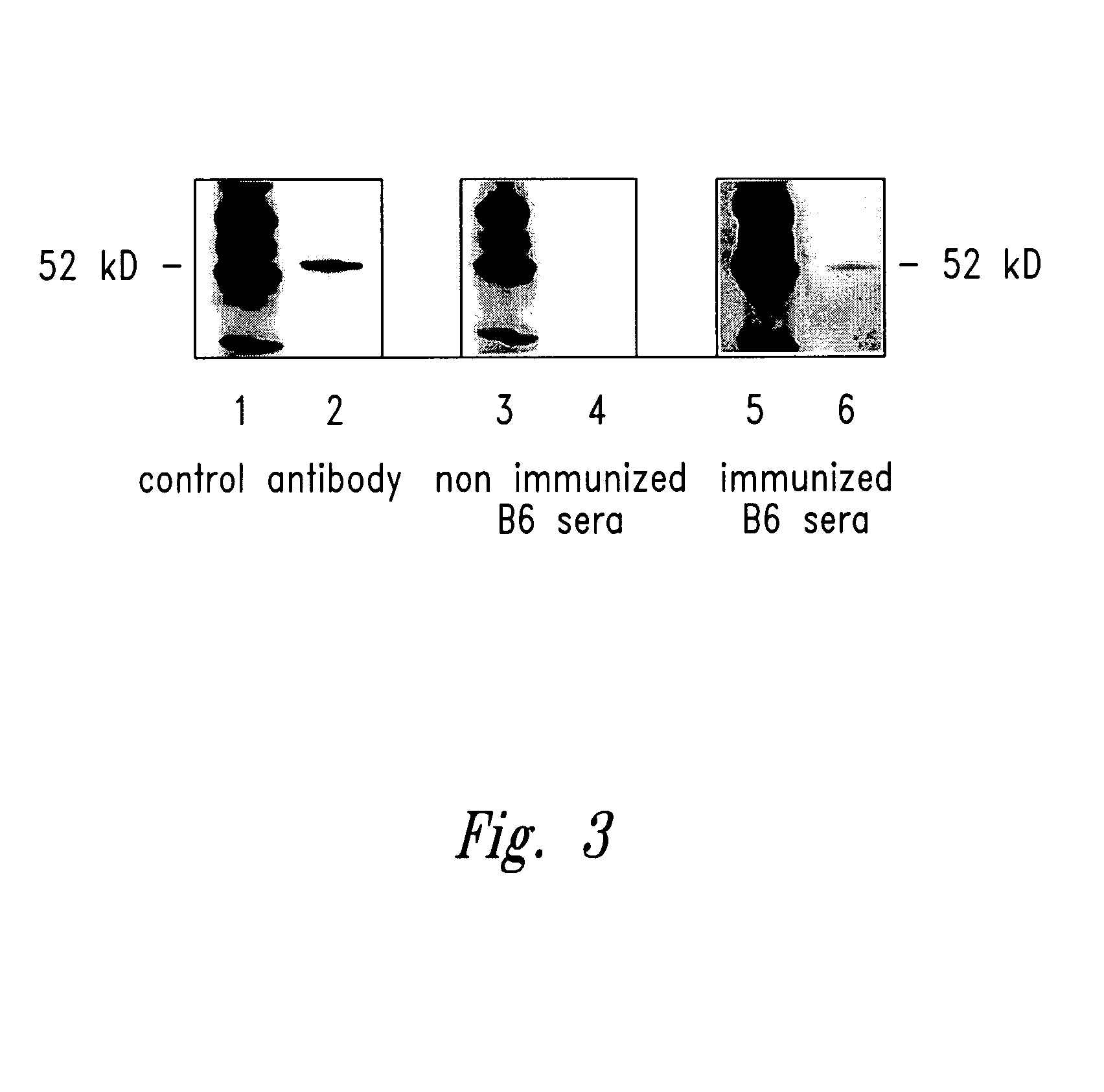 Compositions and methods for WT1 specific immunotherapy