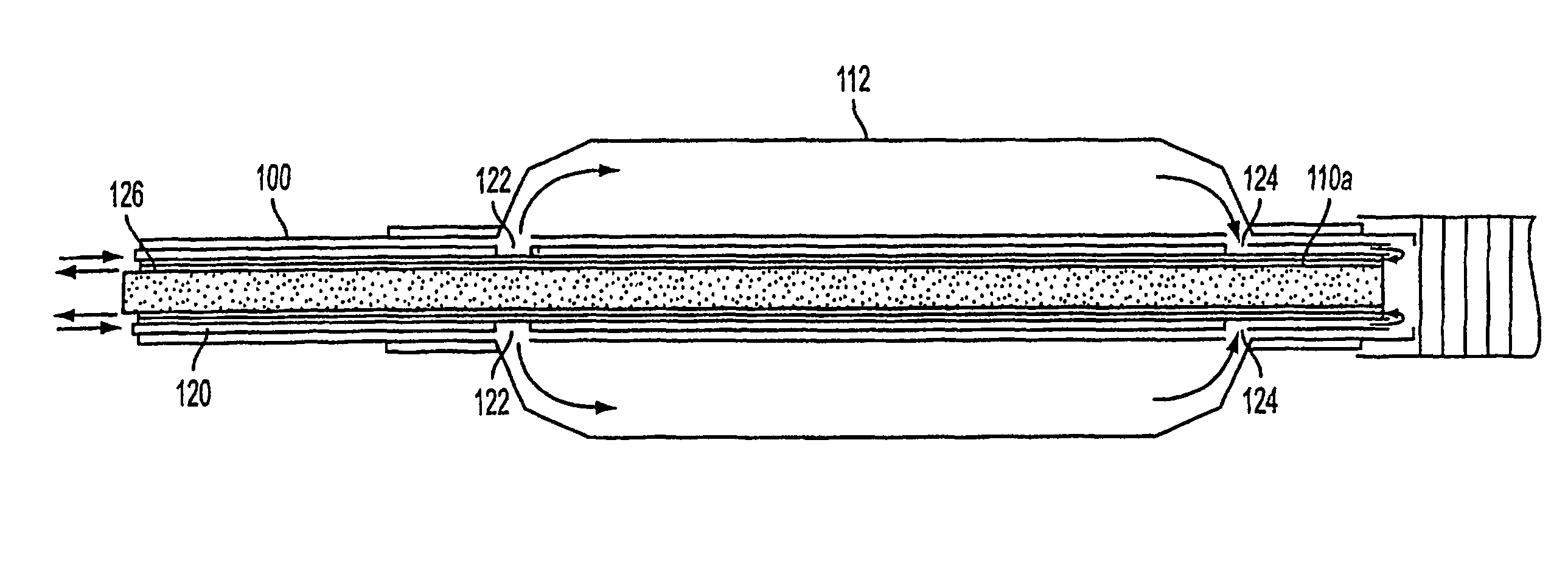 Method and apparatus treating tissue adjacent a bodily conduit with thermocompression and drugs
