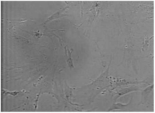 Method for preparing human adipose-derived stem cell culture solution and application thereof in cosmetic products