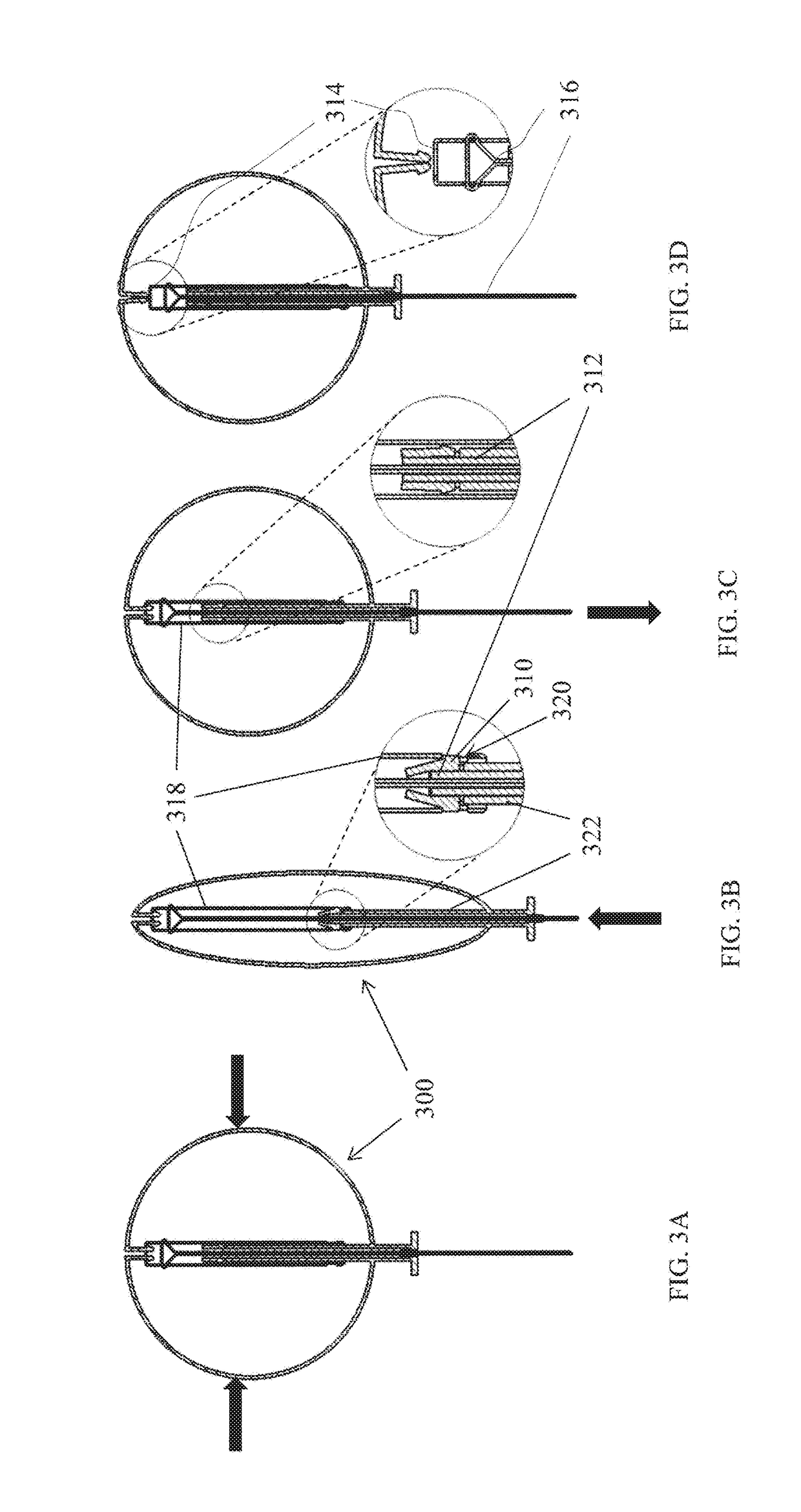 Devices and methods for pelvic organ prolapse alleviation