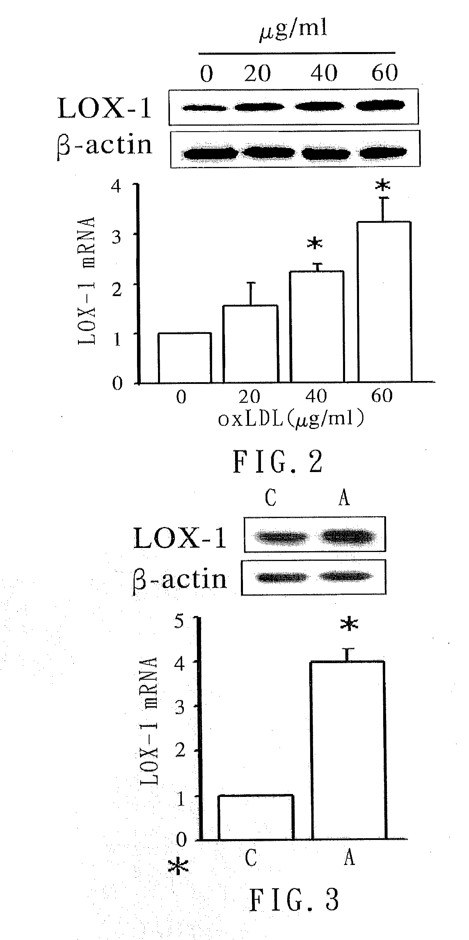 Method of therapy and diagnosis of atherosclerosis