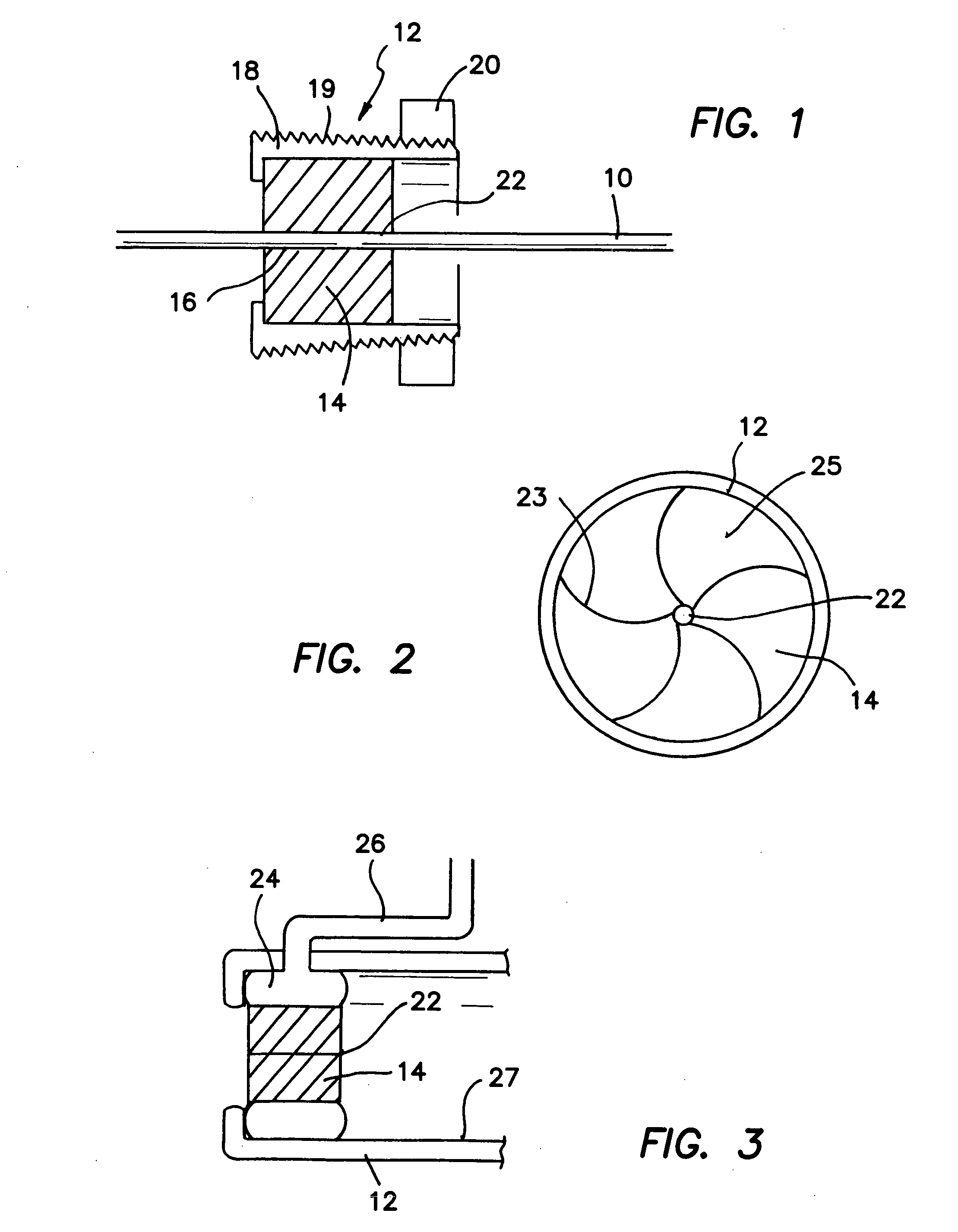 Method and apparatus with a splittable hemostatic valve with a variable aperture