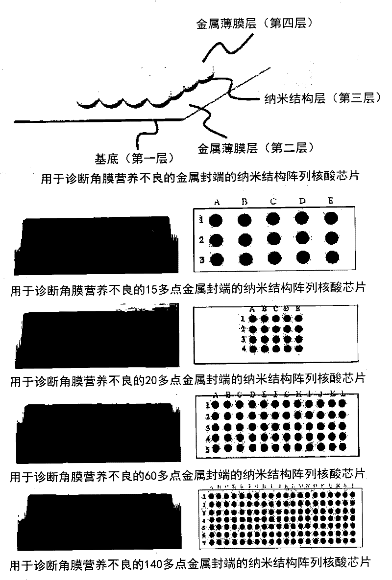 Multi-spot metal-deposited nucleic acid chip with nanostructure arrays for diagnosing corneal dystrophy, and method for producing same