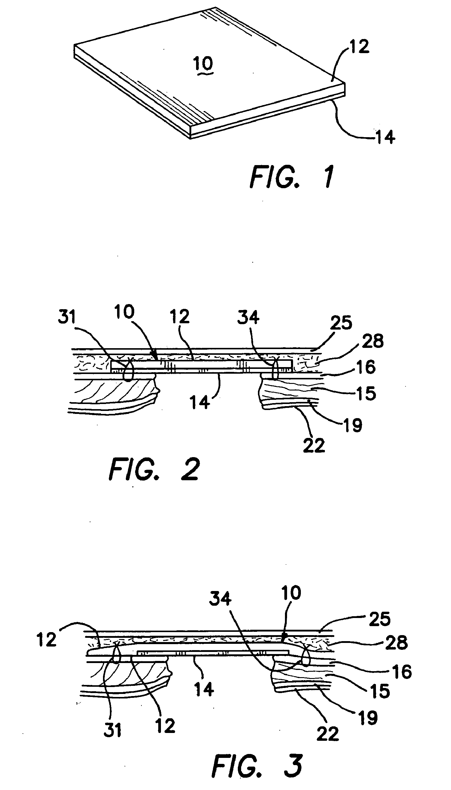 Surgical prosthesis having biodegradable and nonbiodegradable regions