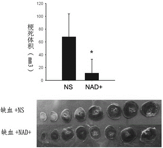 Application of nicotinamide adenine dinucleotide in preparation of drug for preventing and treating heart ischemic injuries