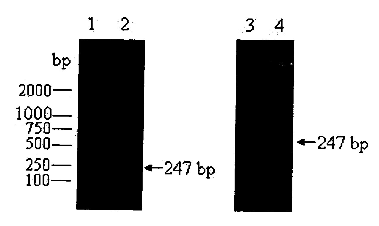 Human complement fragment C5a gene as well as clone and recombinant protein expression method thereof