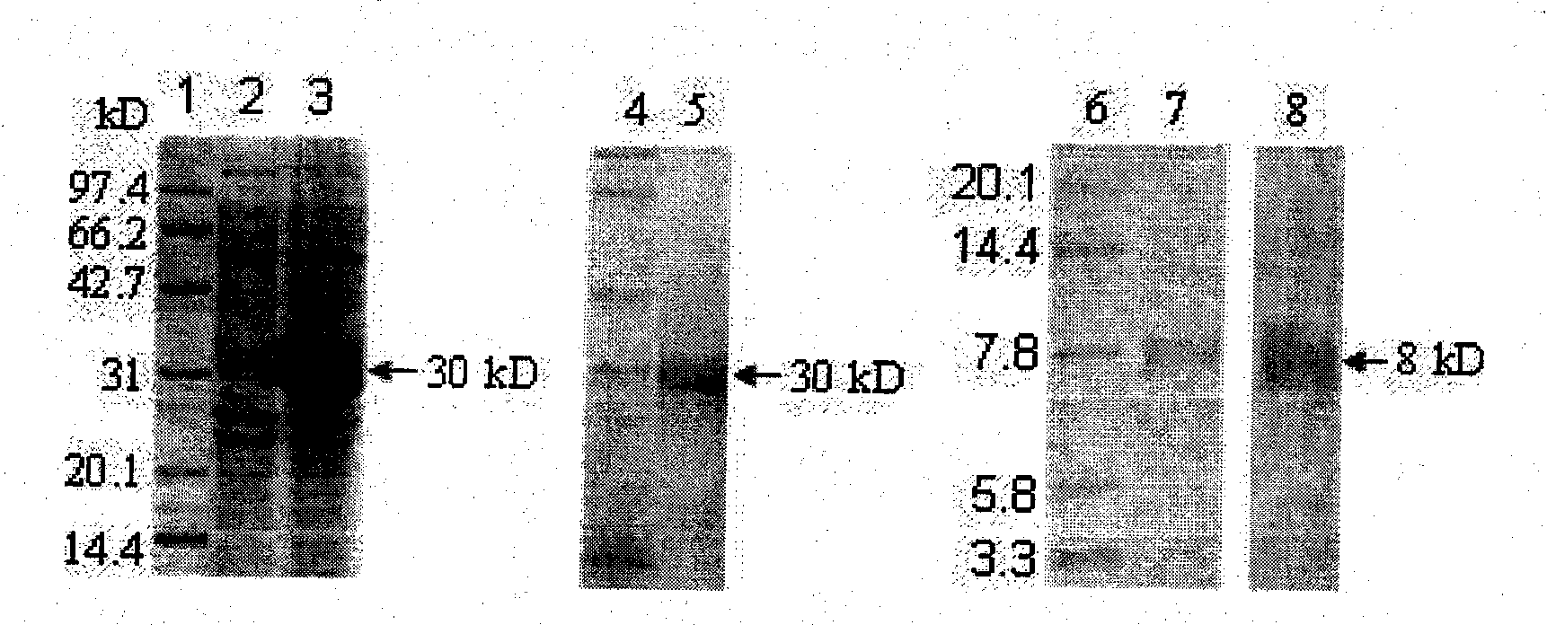 Human complement fragment C5a gene as well as clone and recombinant protein expression method thereof