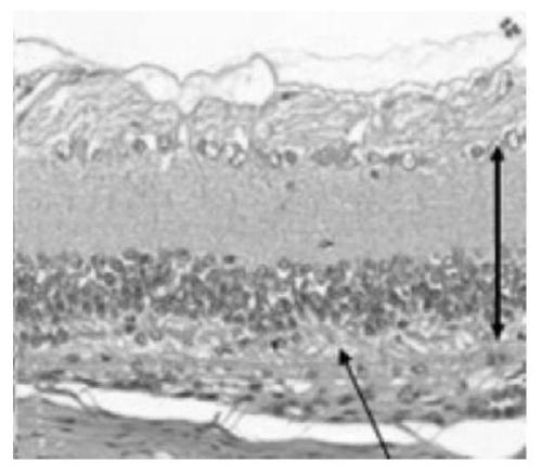 A kind of retinal progenitor cell with the function of treating retinal degeneration and its preparation