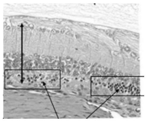 A kind of retinal progenitor cell with the function of treating retinal degeneration and its preparation