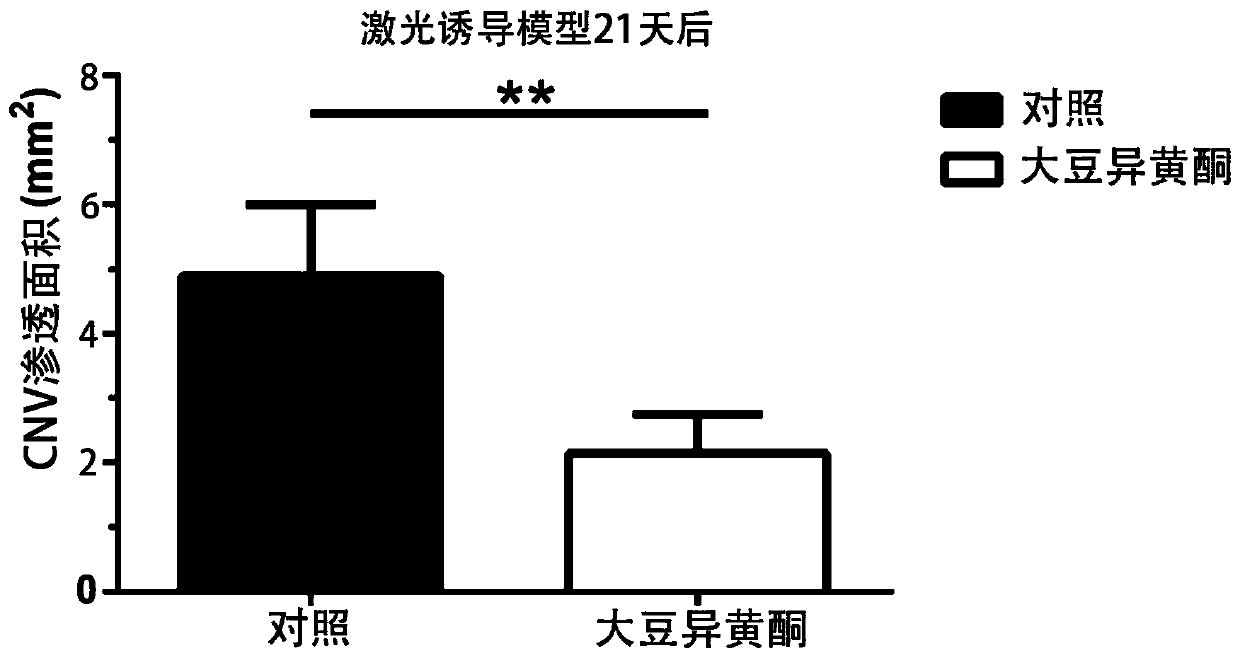 Application of isoflavone in preparation of drug for treating fundus maculopathy