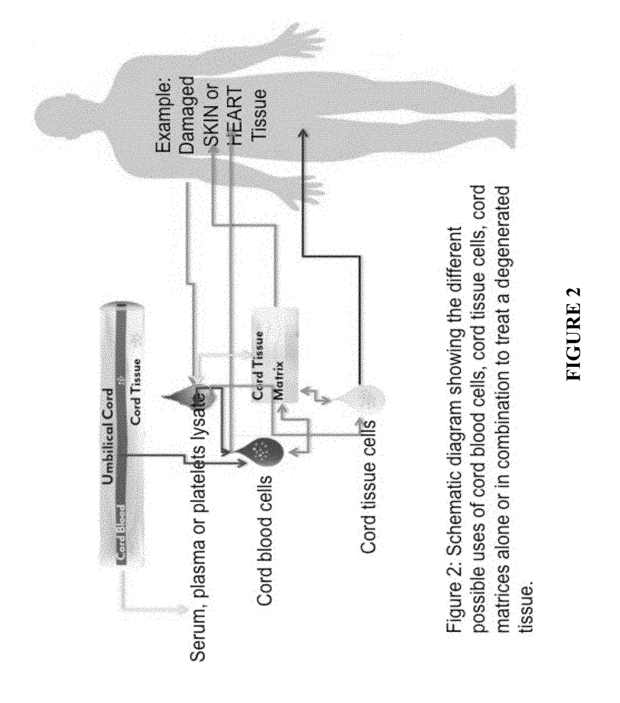 Stem cells & decellularized tissue matrix from cord tissue