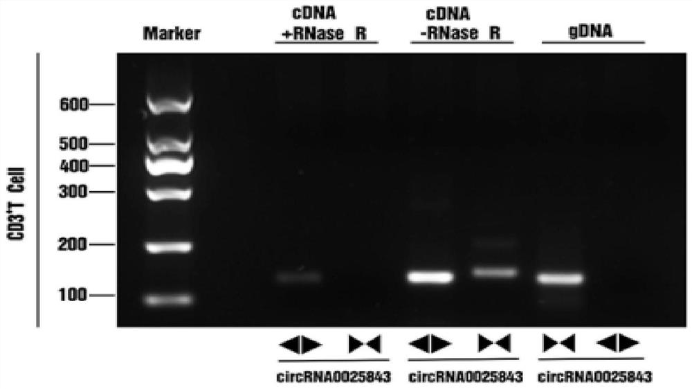 A sle-related circular RNA hsa_circ_0025843 and its application