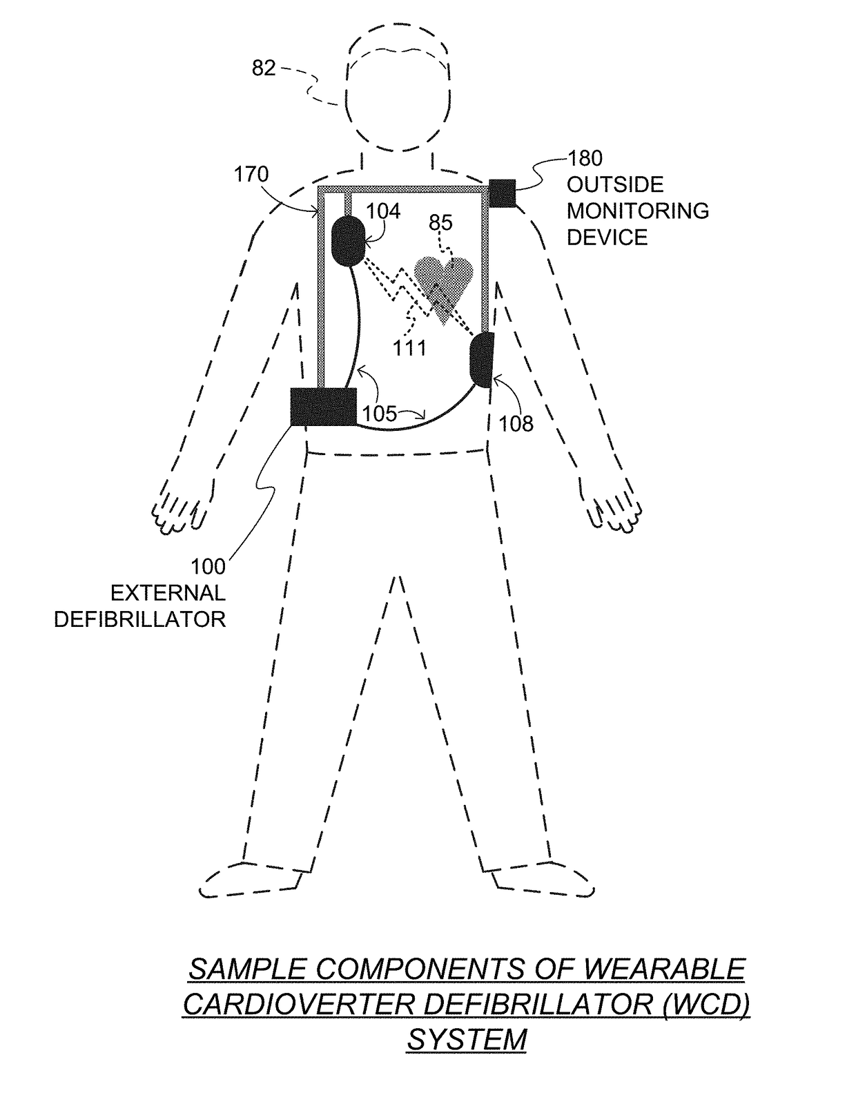 Wearable cardioverter defibrillator (WCD) system computing patient heart rate by multiplying ECG signals from different channels