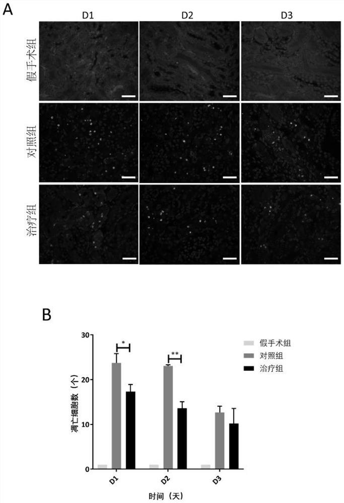 Application of human amniotic epithelial stem cells in preparation of medicine for treating acute kidney injury