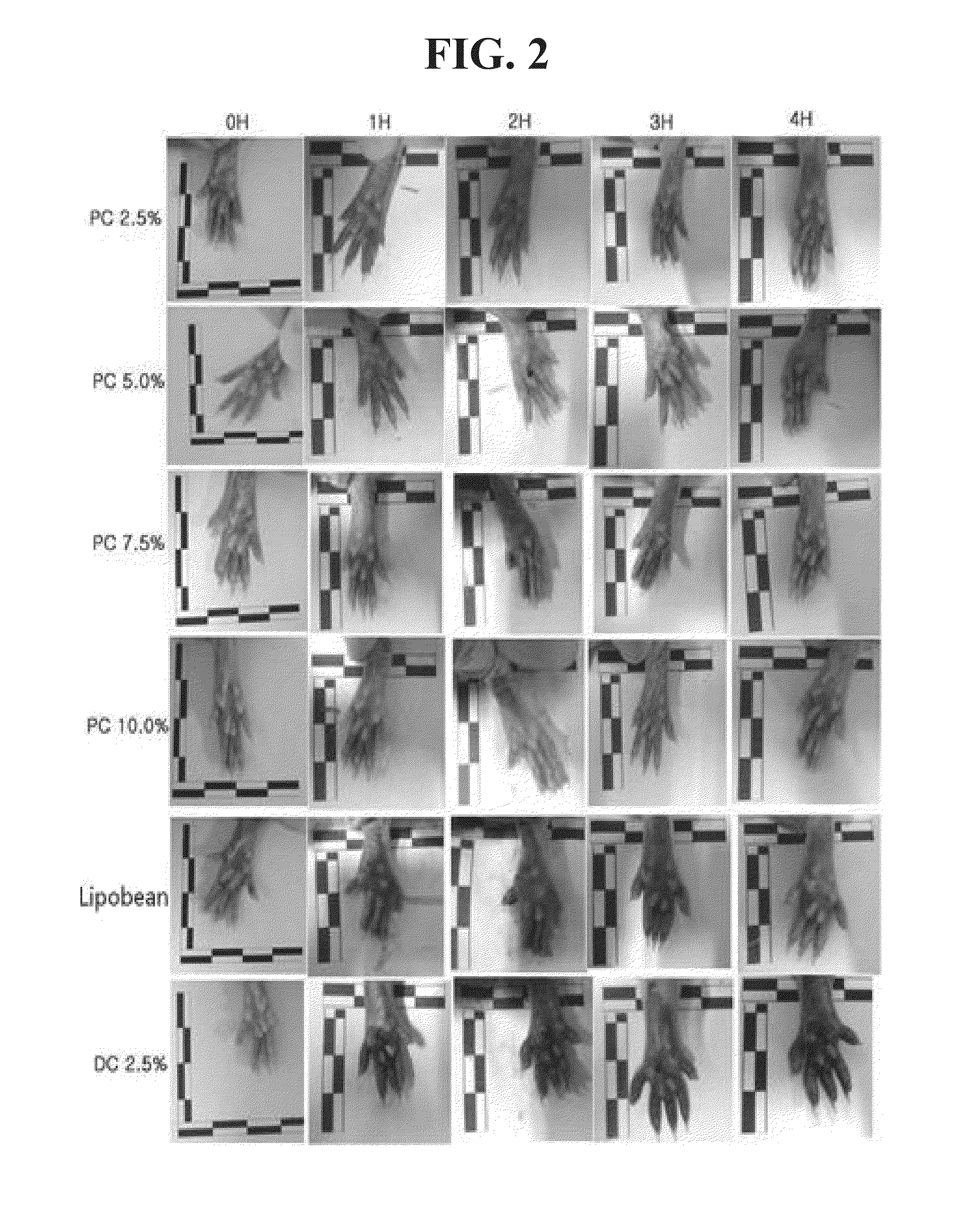 Composition for lipolysis, containing phosphatidylcholine, and preparation method therefor