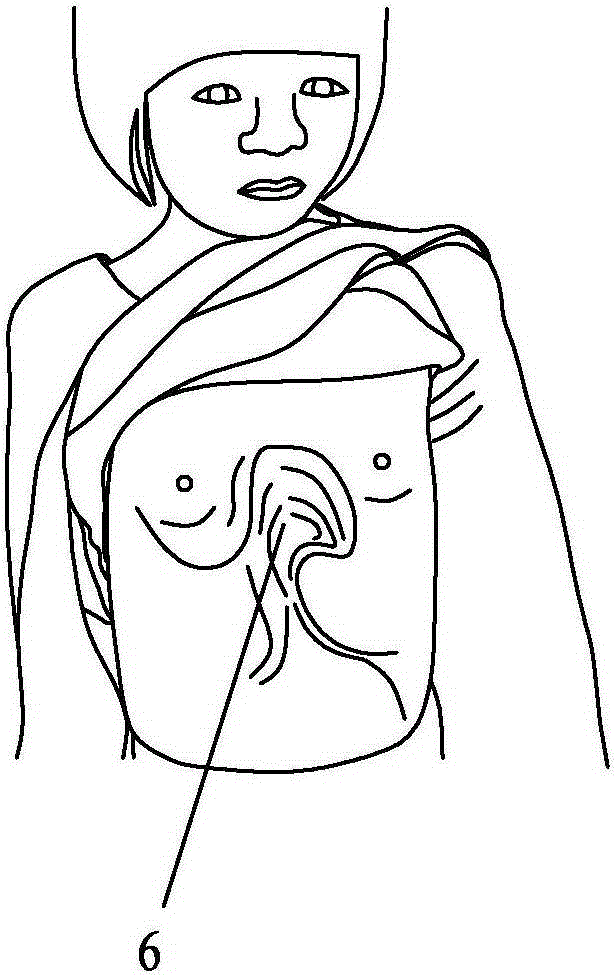 Negative-pressure sucker capable of automatically fitting chest outline