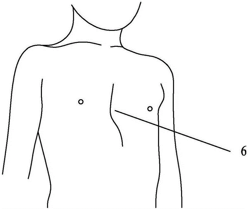 Negative-pressure sucker capable of automatically fitting chest outline