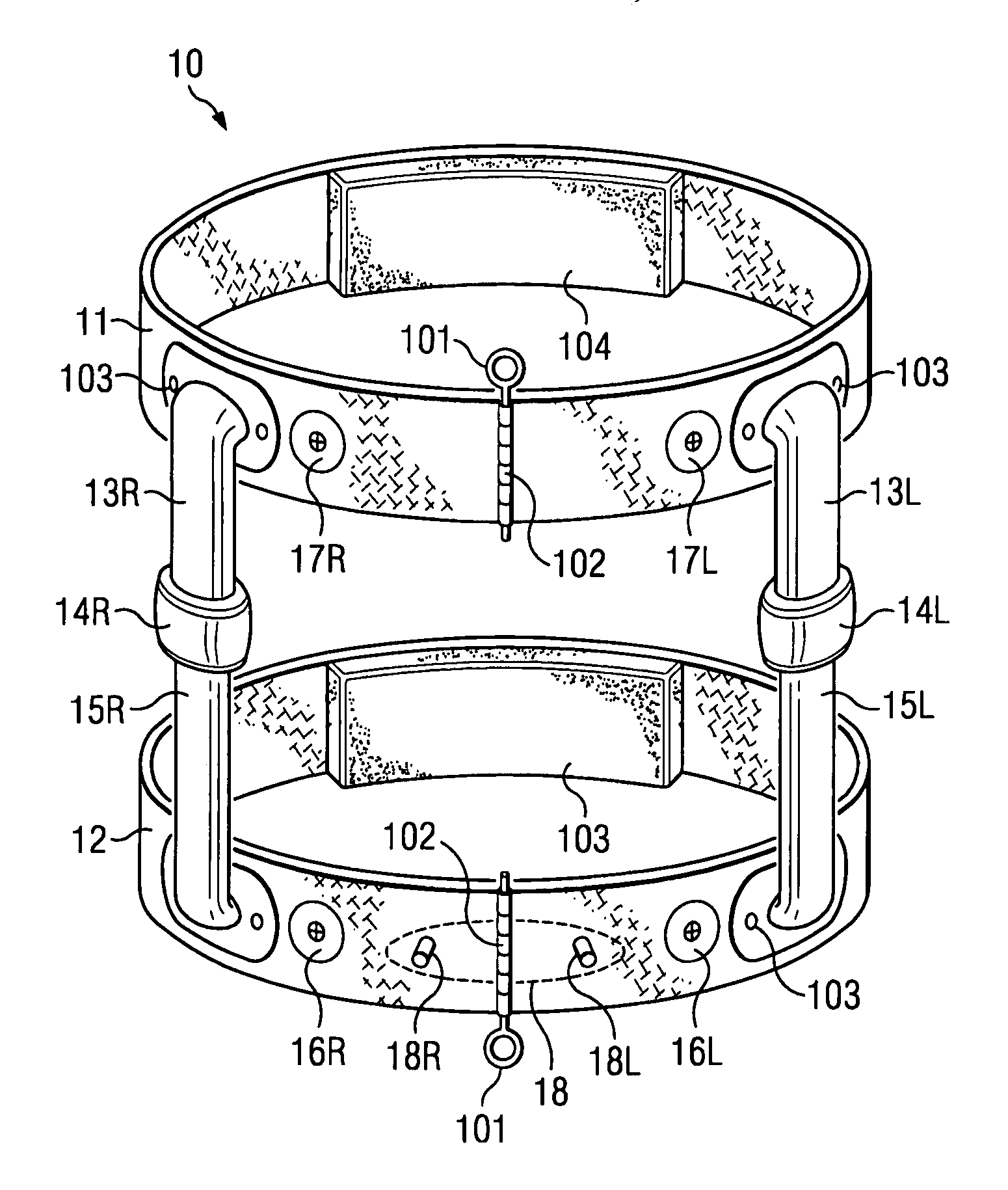 System and method for externally controlled surgical navigation