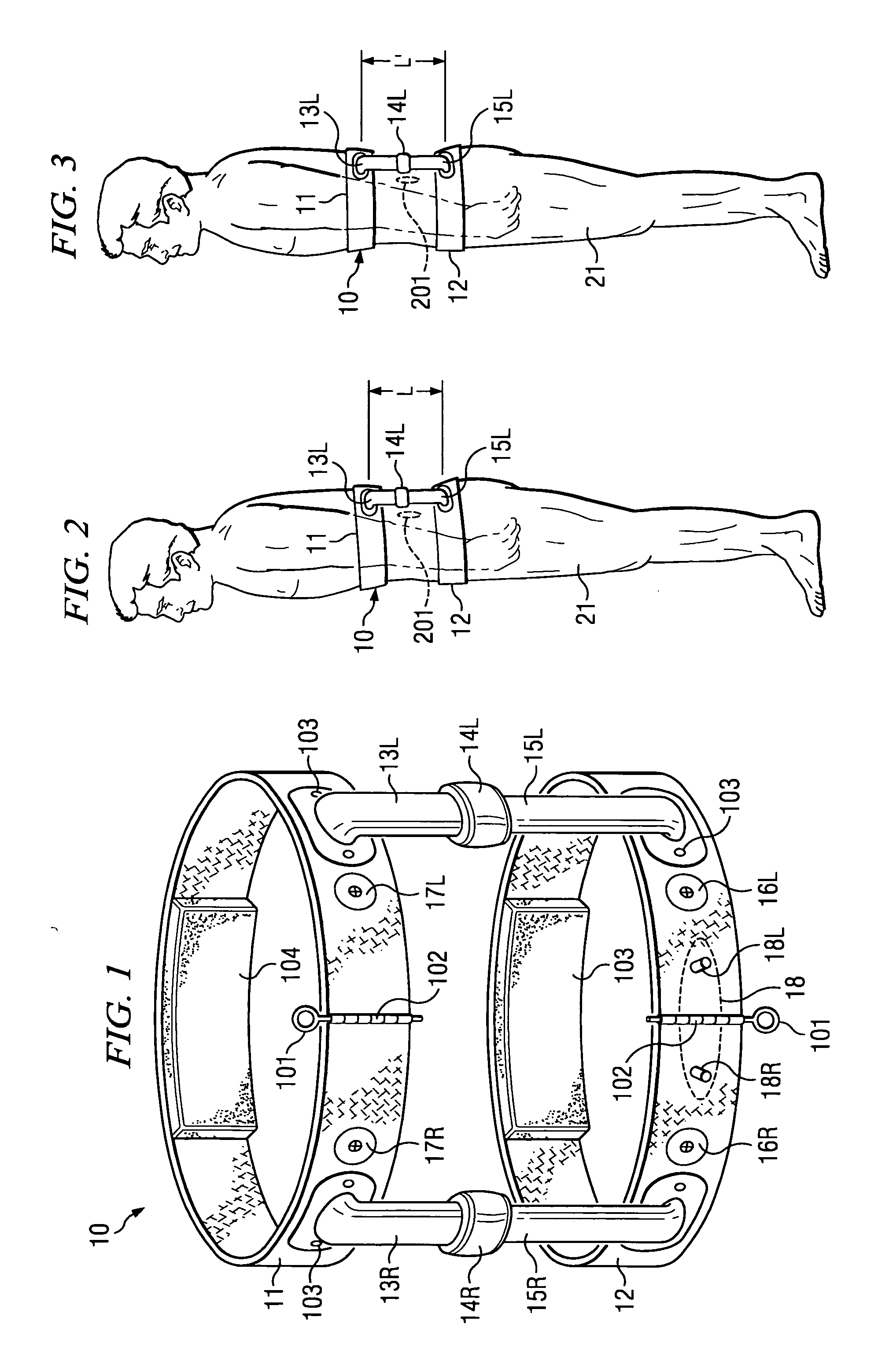 System and method for externally controlled surgical navigation