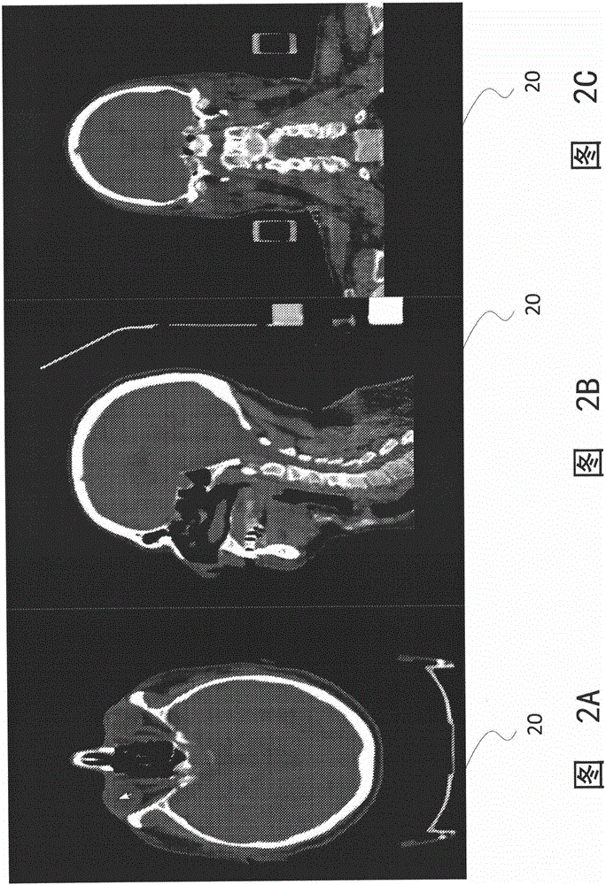 System and method for patient-specific radiotherapy treatment verification and quality assurance