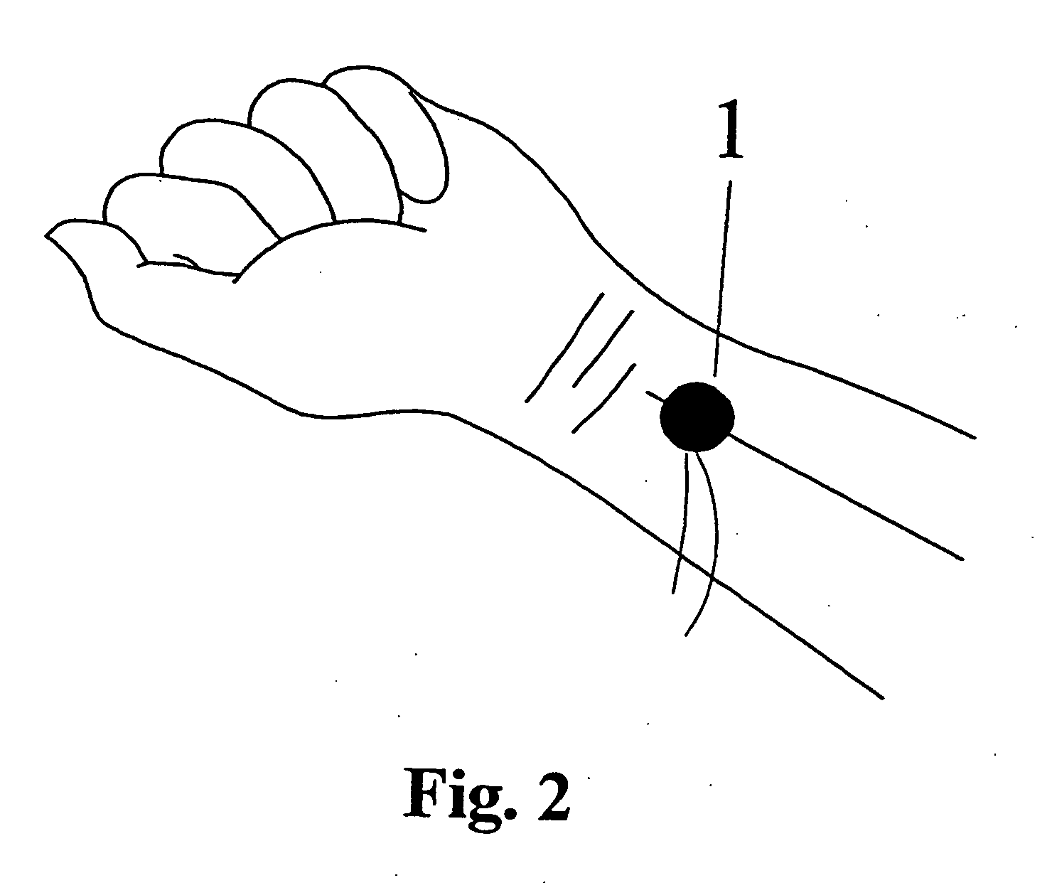 Non-invasive radial artery blood pressure waveform measuring apparatus system and uses thereof