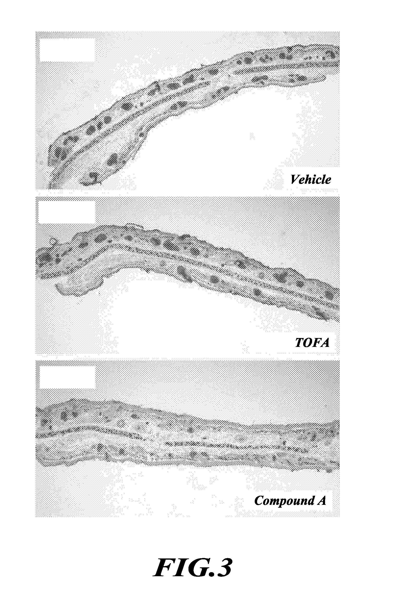 TOFA analogs useful in treating dermatological disorders or conditions