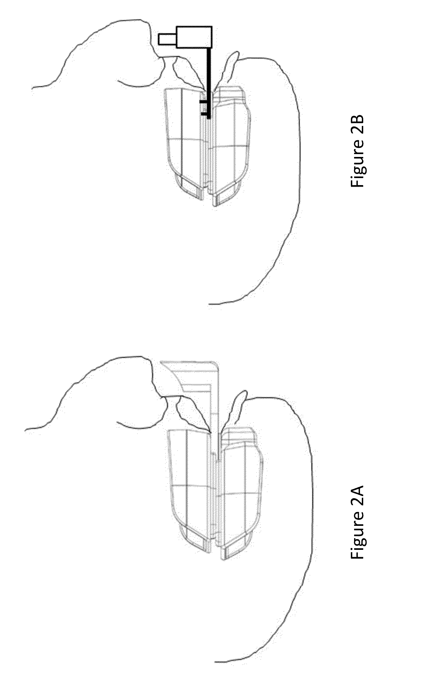 Oral Appliance Monitor and Method of Using the Same