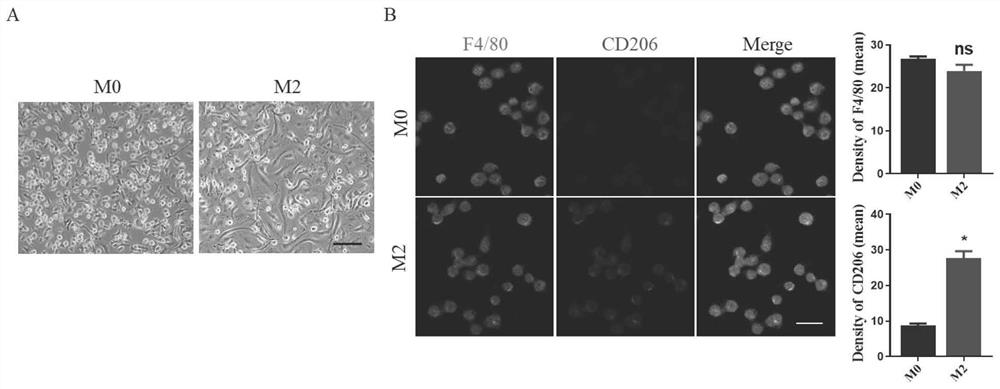 M2 type bone marrow macrophage exosome, application thereof and spinal cord injury treatment preparation