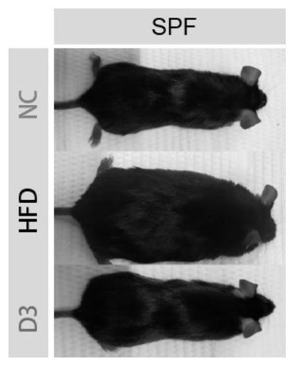 Medicine for inhibiting dietary obesity and polypeptide used by medicine