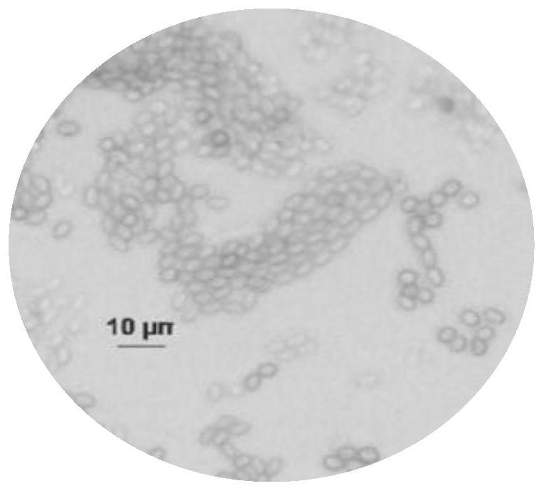 Preparation method of penicillium oxalicum and application of penicillium oxalicum in phosphate solubilizing, growth promoting and fusarium graminearum antagonism