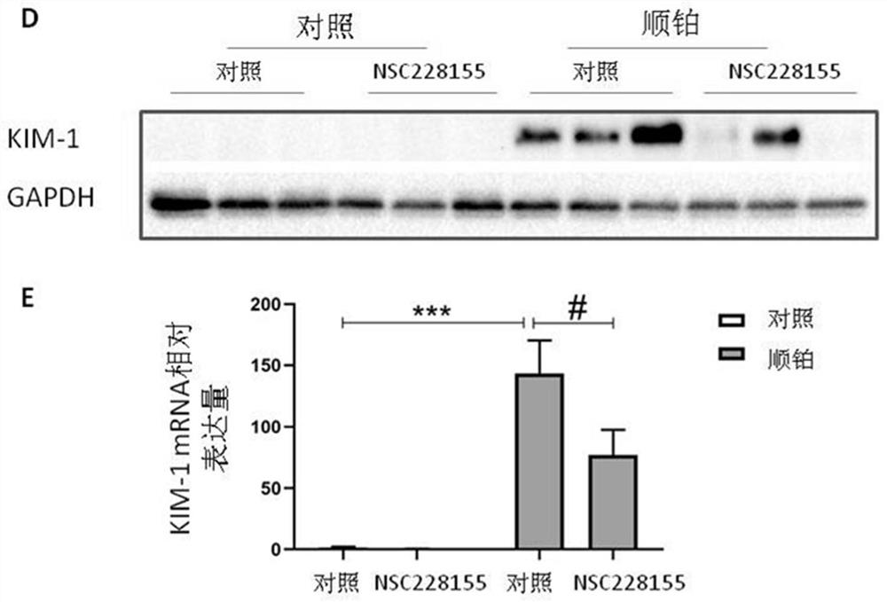 Use of nsc228155 in the preparation of medicines for preventing and treating acute kidney injury