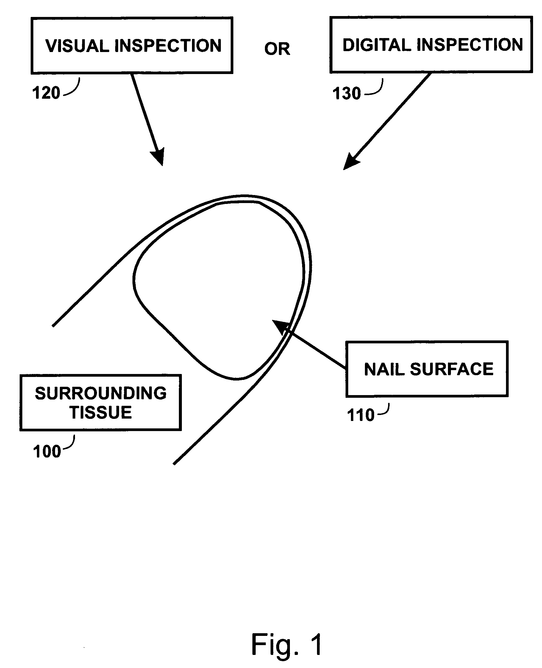 Method and process for detecting a nail surface