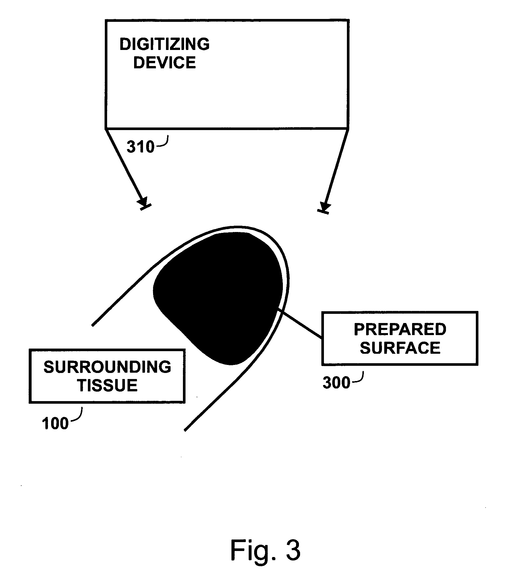 Method and process for detecting a nail surface