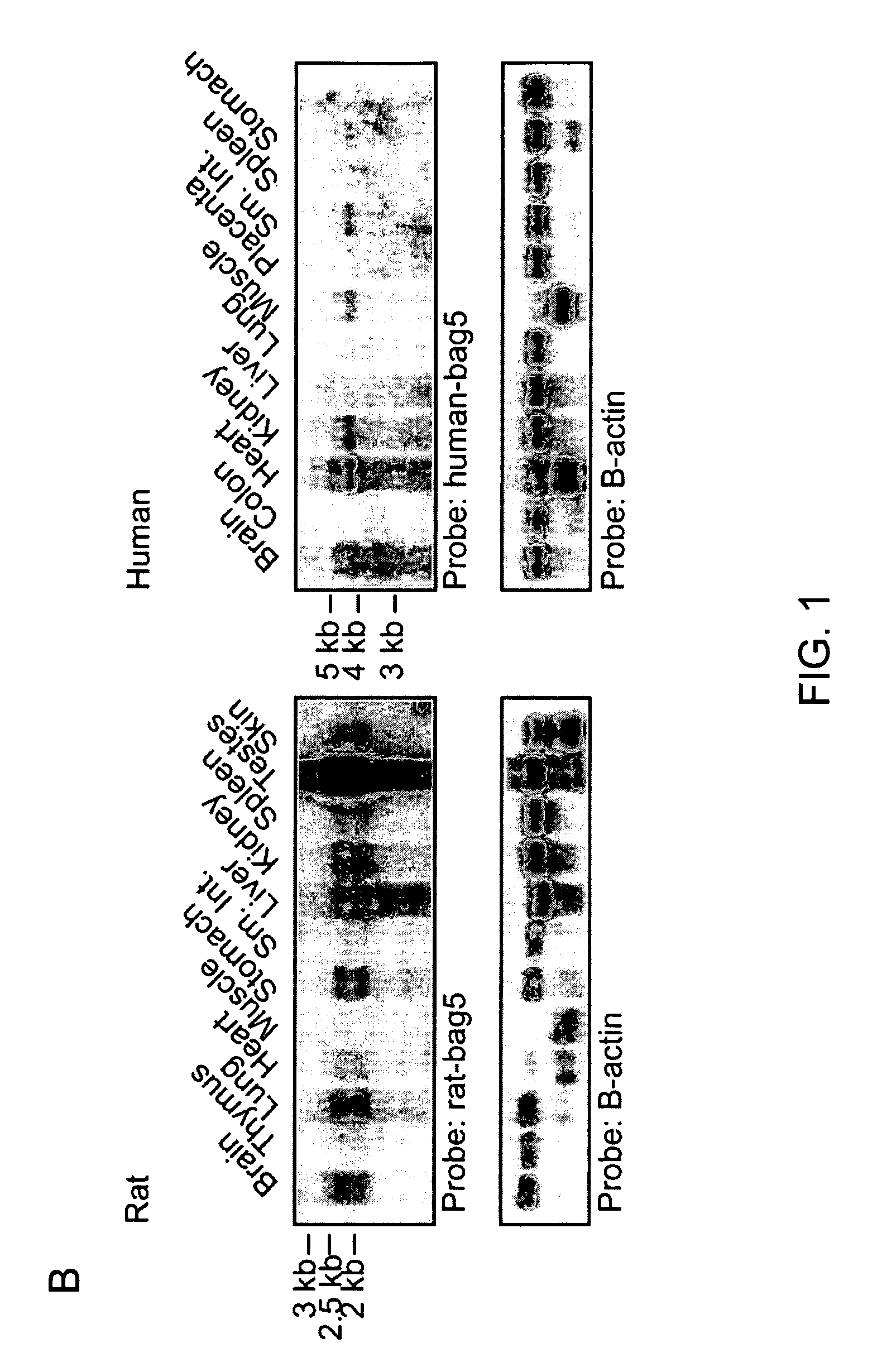Compositions and methods to inhibit cell loss by using inhibitors of BAG