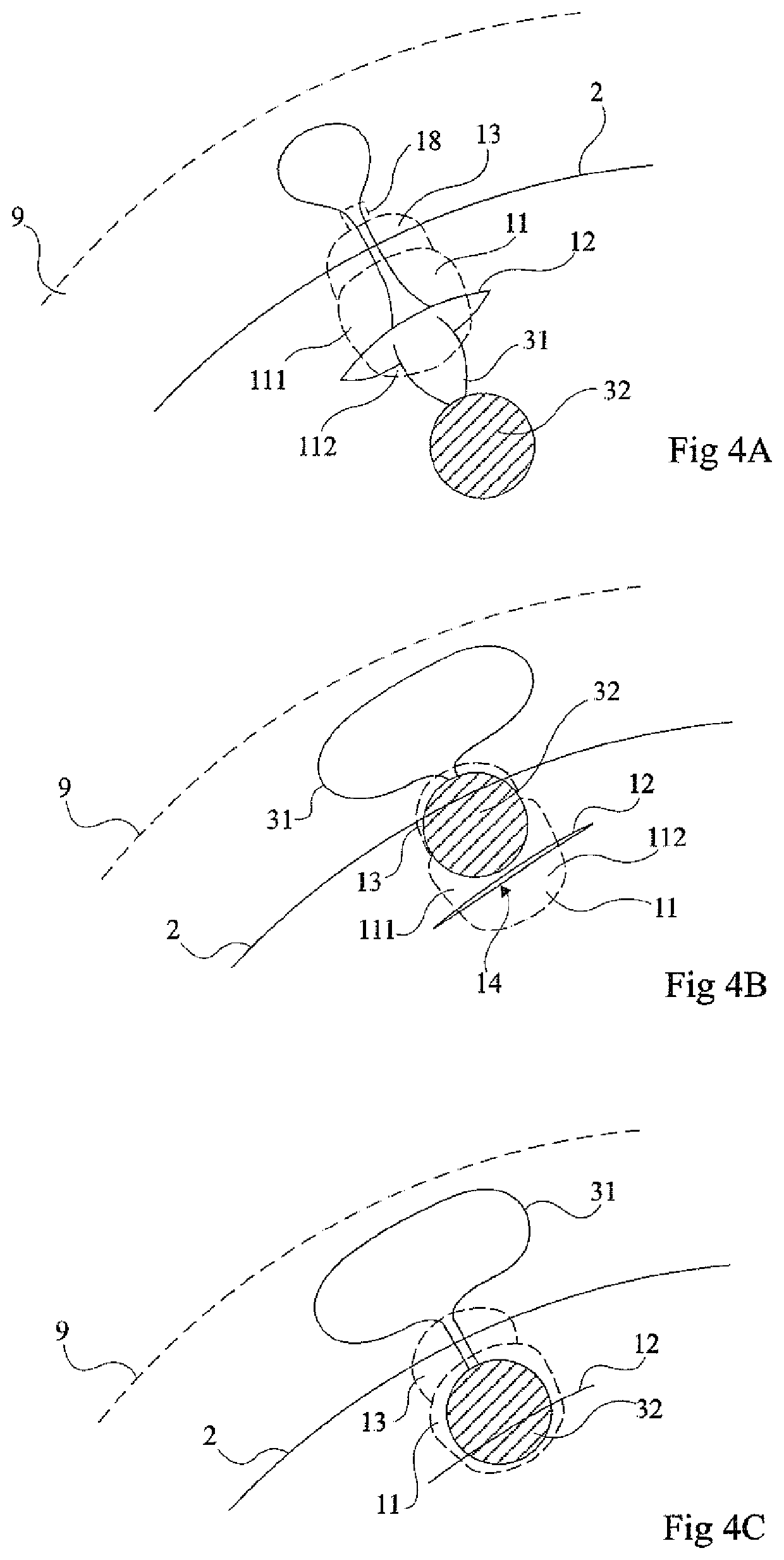 System for measuring intraocular pressure