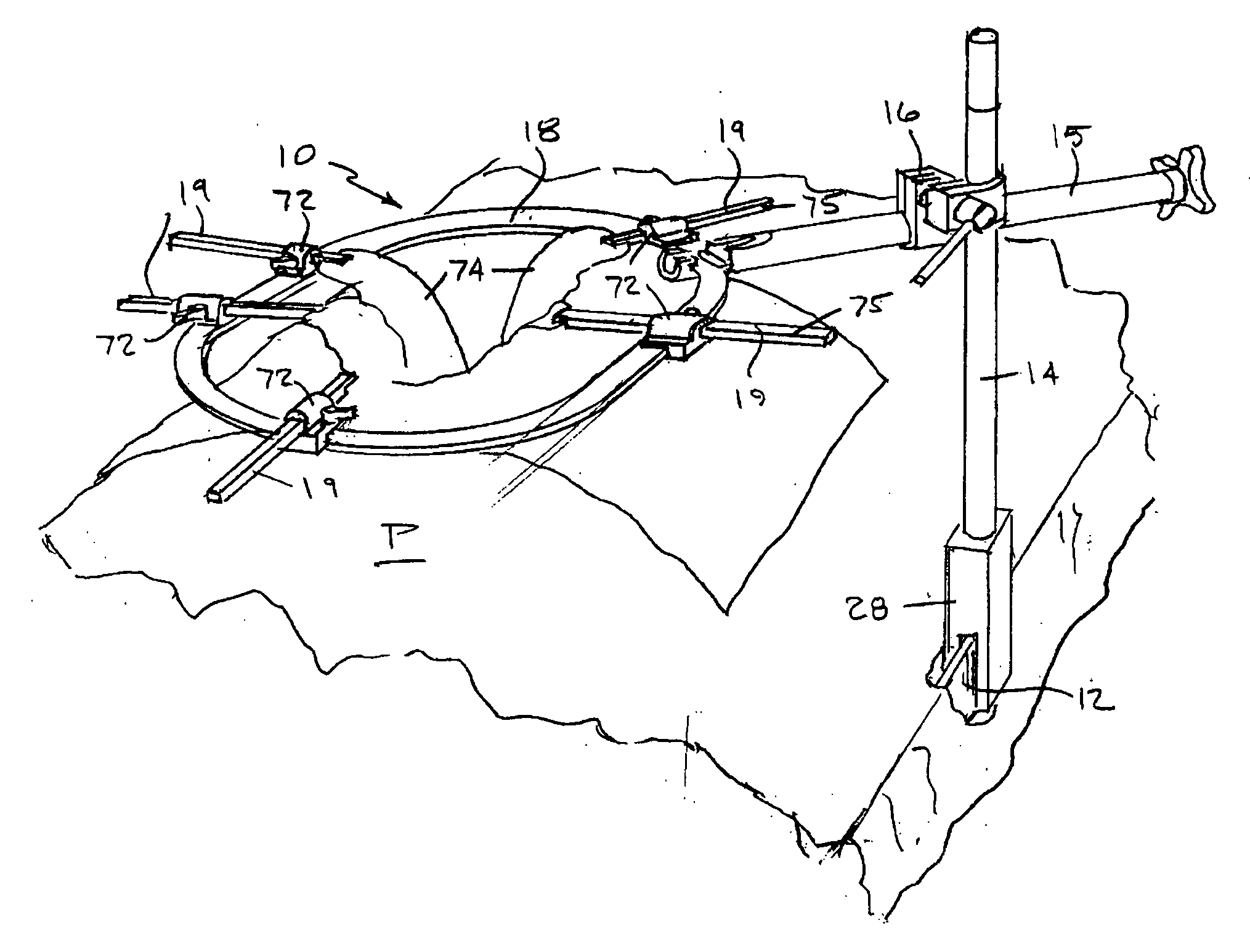 Disposable padding for a self-retaining retraction device