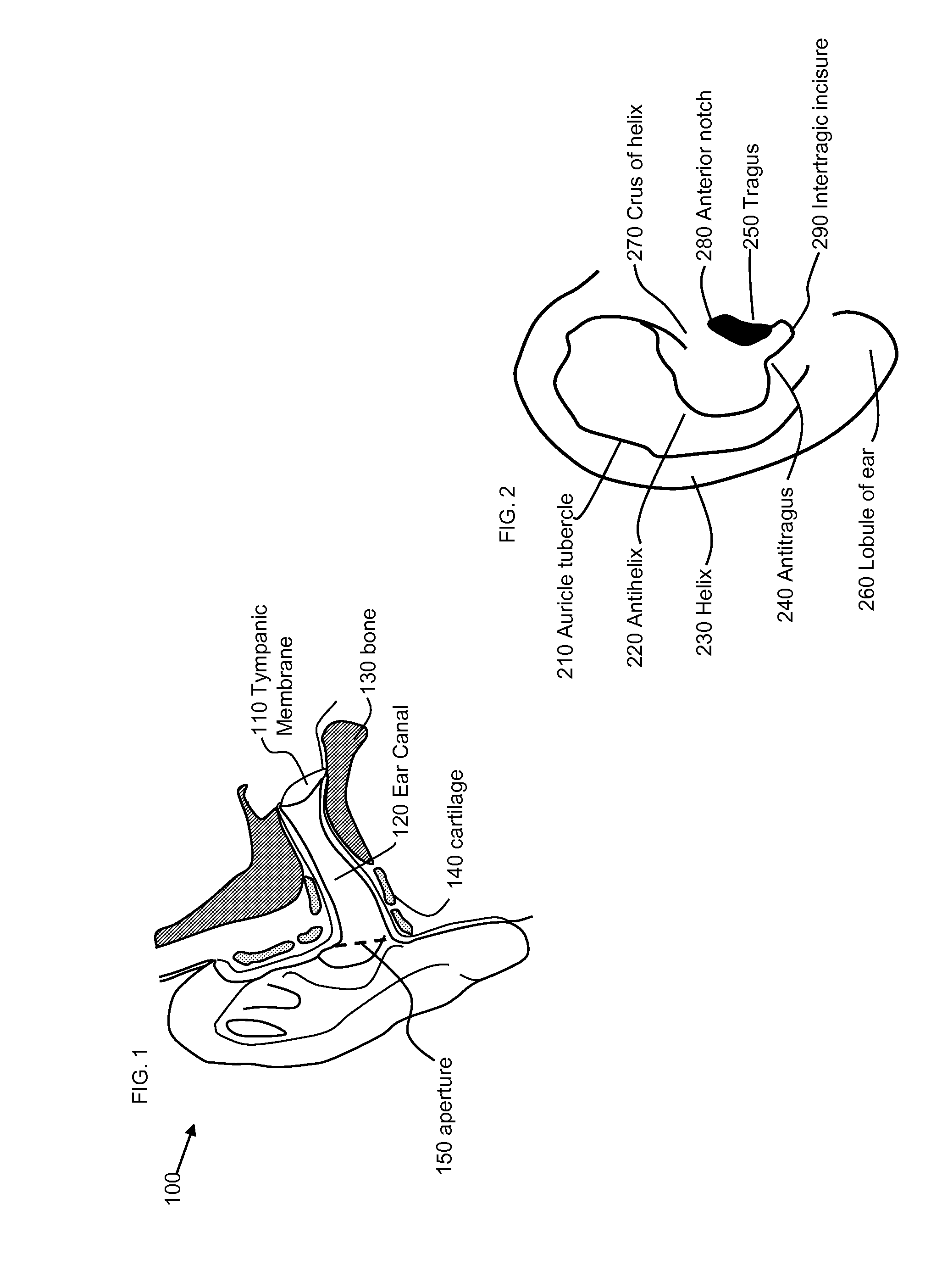Method and structure for achieveing acoustically spectrum tunable earpieces, panels, and inserts