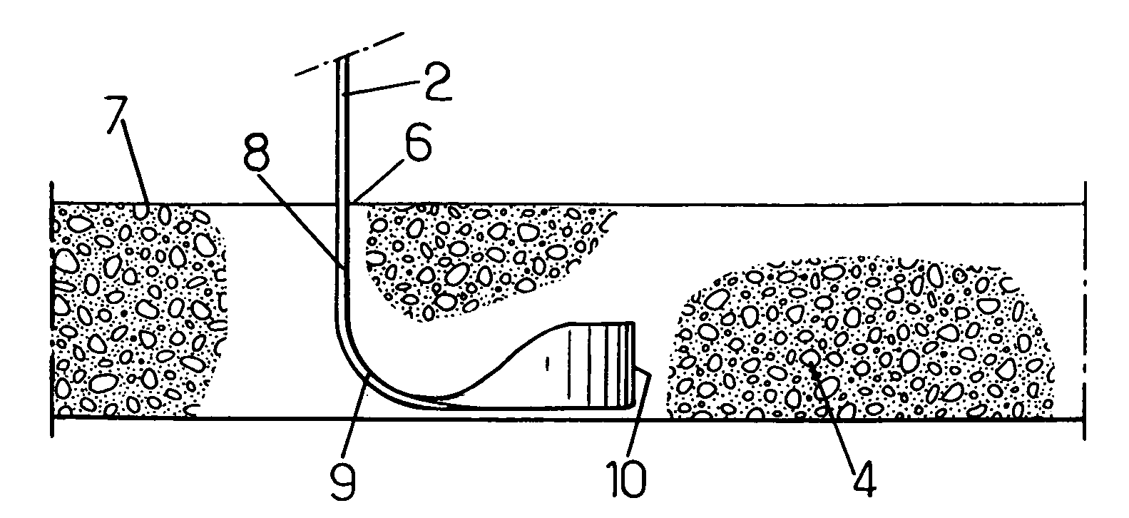 Stabilized soil structure and facing elements for its construction