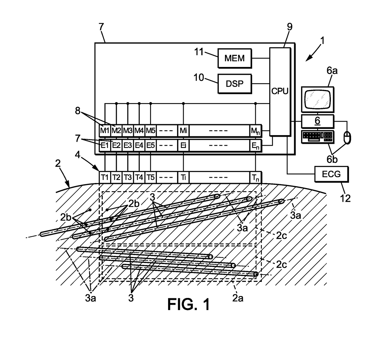 Shear wave elastrography method and apparatus for imaging an anisotropic medium