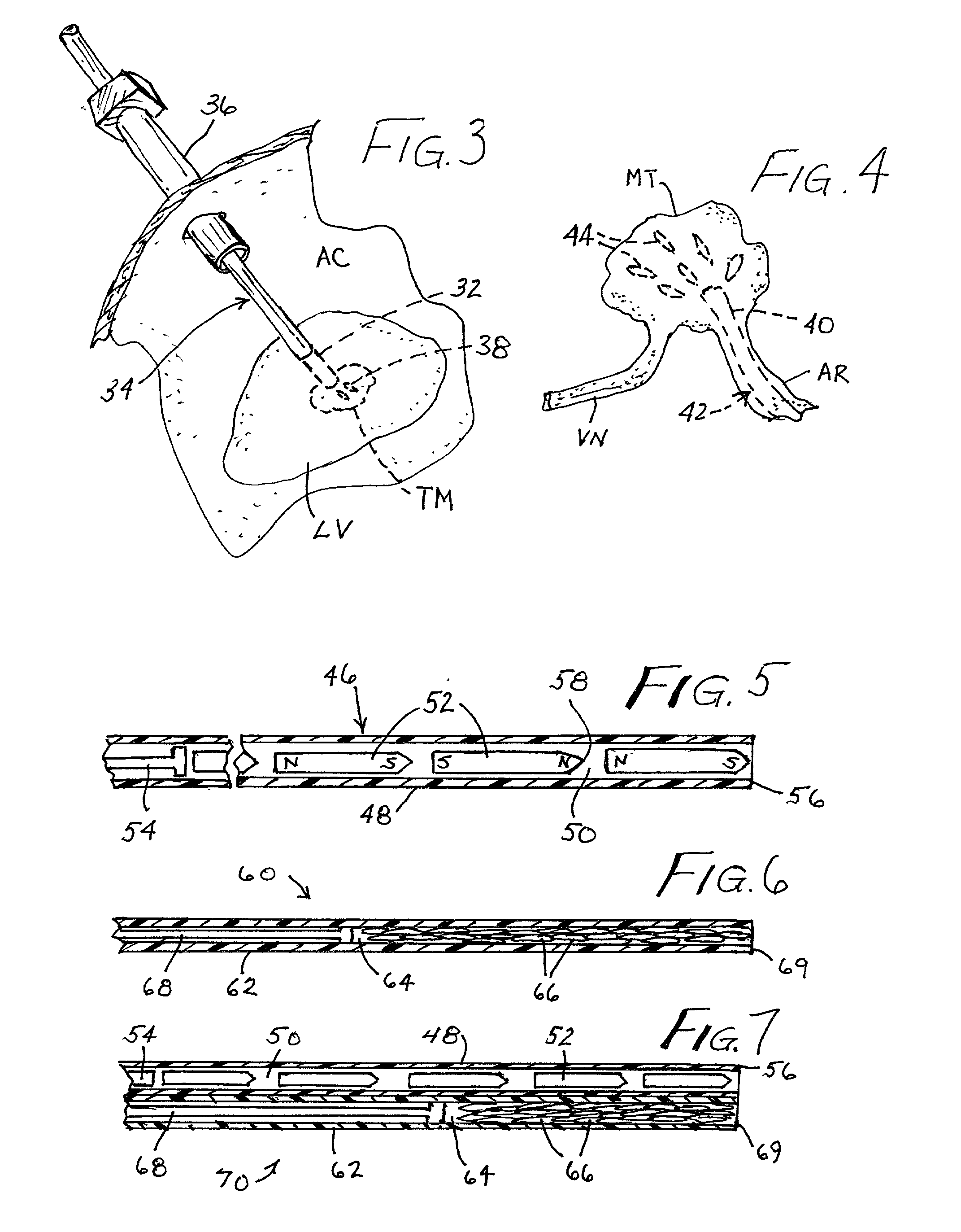 Medical treatment method and device utilizing magnetic particles