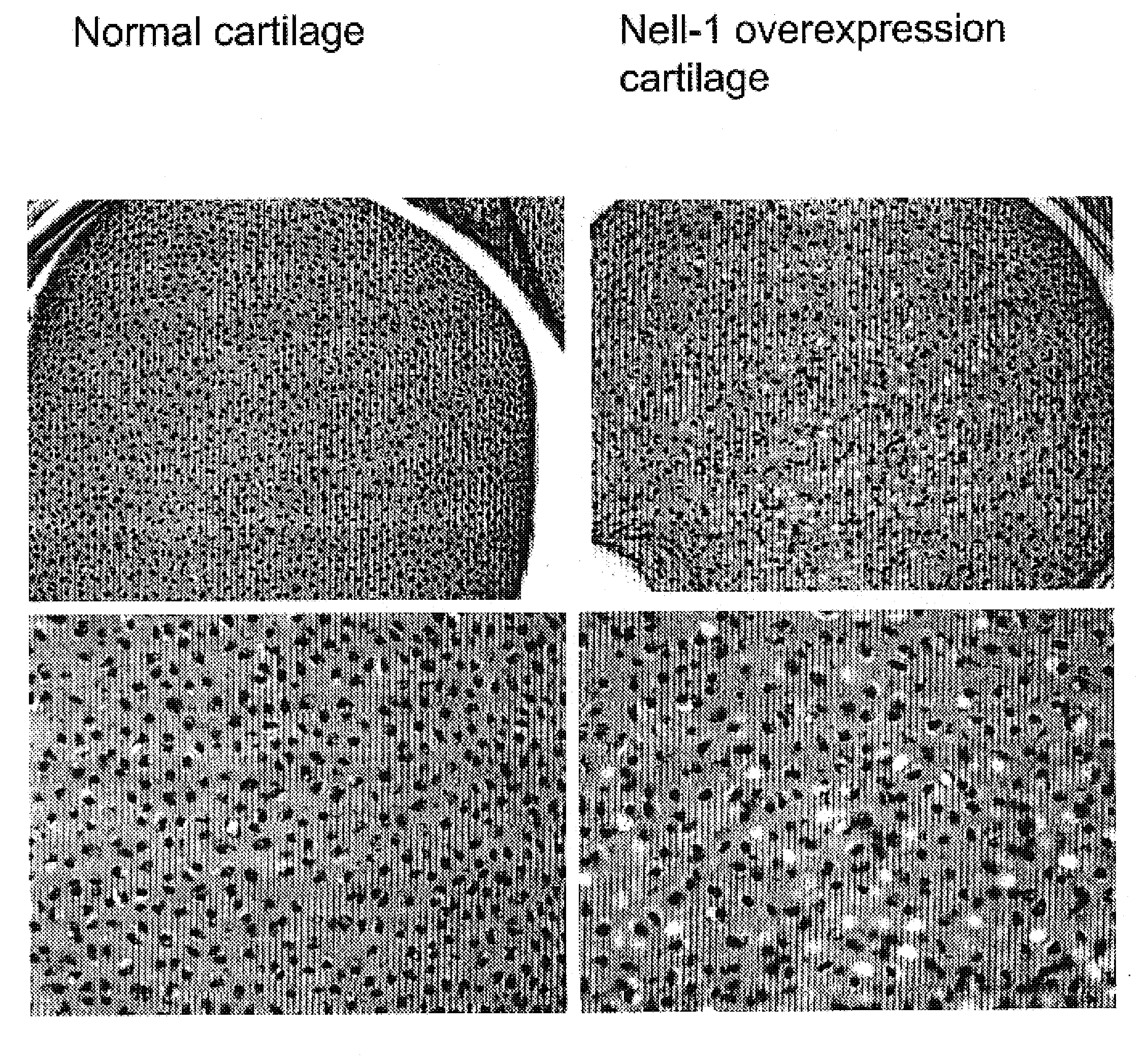 Composition for promoting cartilage formation or repair comprising a nell gene product and method of treating cartilage-related conditions using such composition
