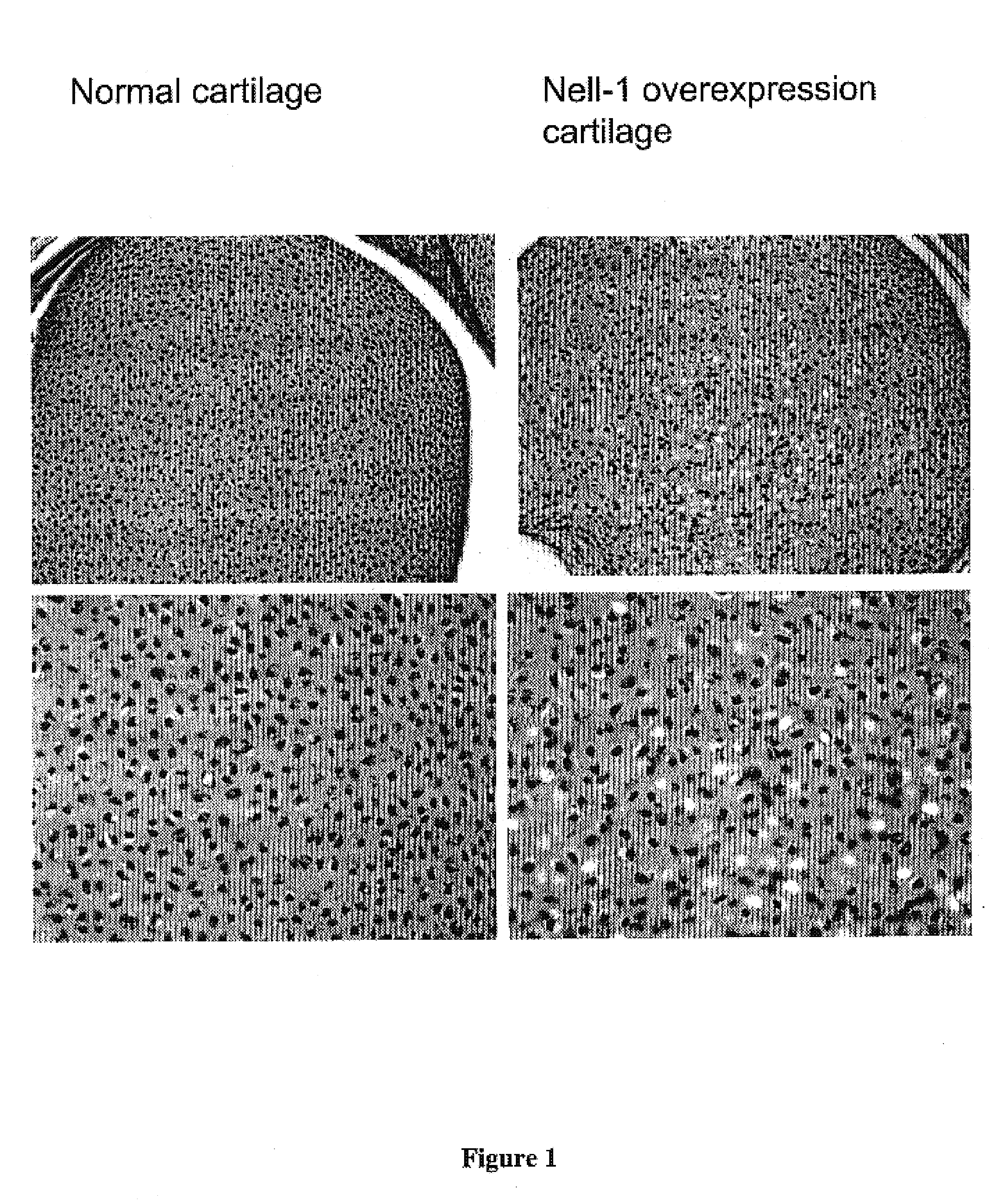 Composition for promoting cartilage formation or repair comprising a nell gene product and method of treating cartilage-related conditions using such composition