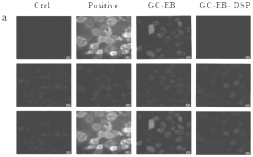 ROS-responsive controlled-release ophthalmic preparation and preparation method thereof