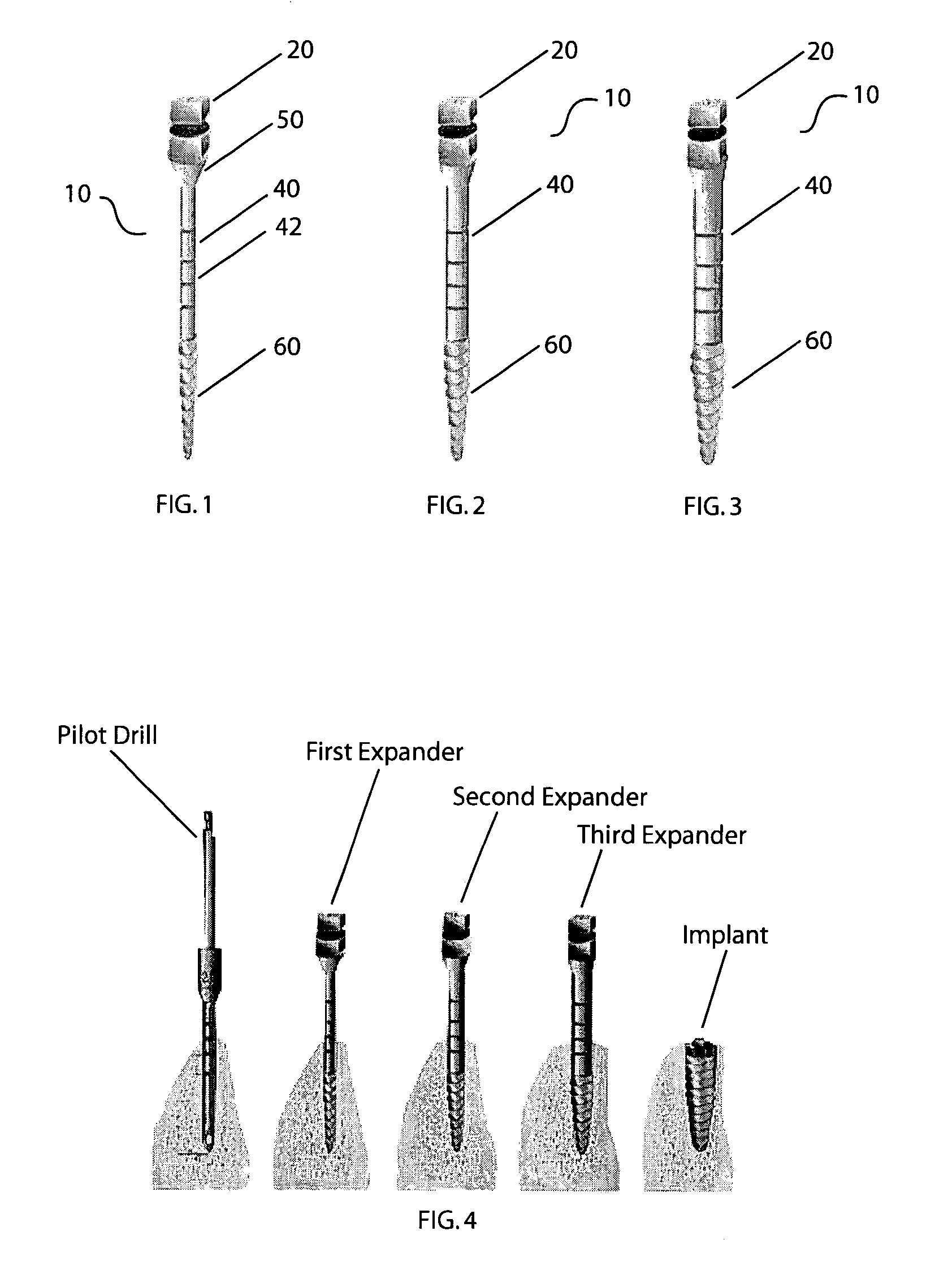 Method of bone expansion and compression for receiving a dental implant using threaded expanders