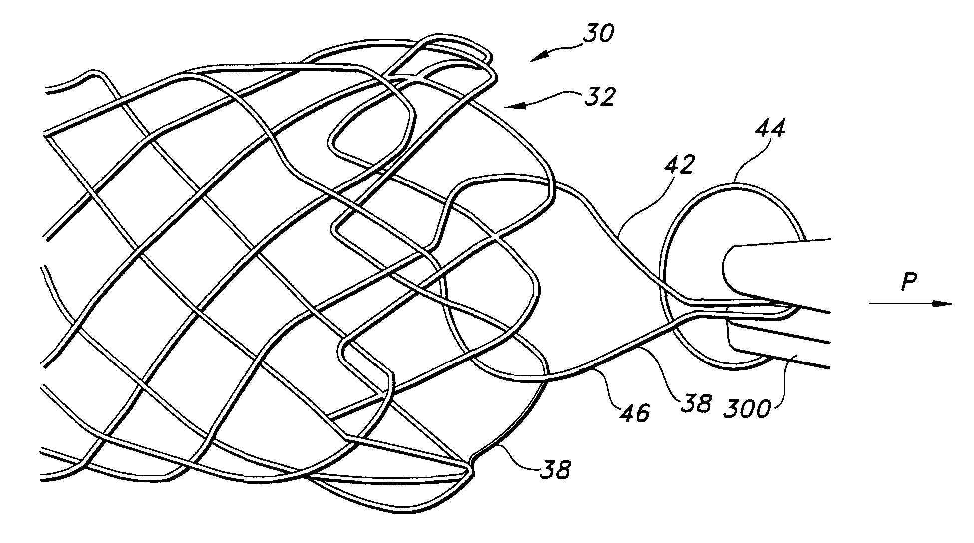 Integrated stent retrieval loop adapted for snare removal and/or optimized purse stringing
