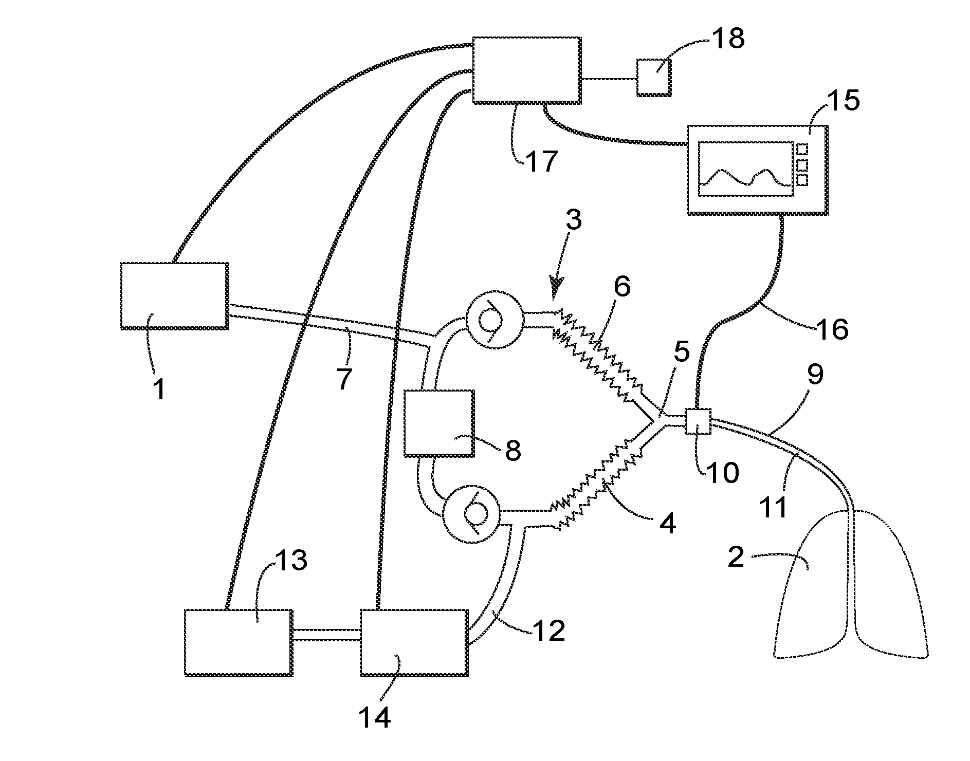 Inhalation anaesthesia delivery system and method