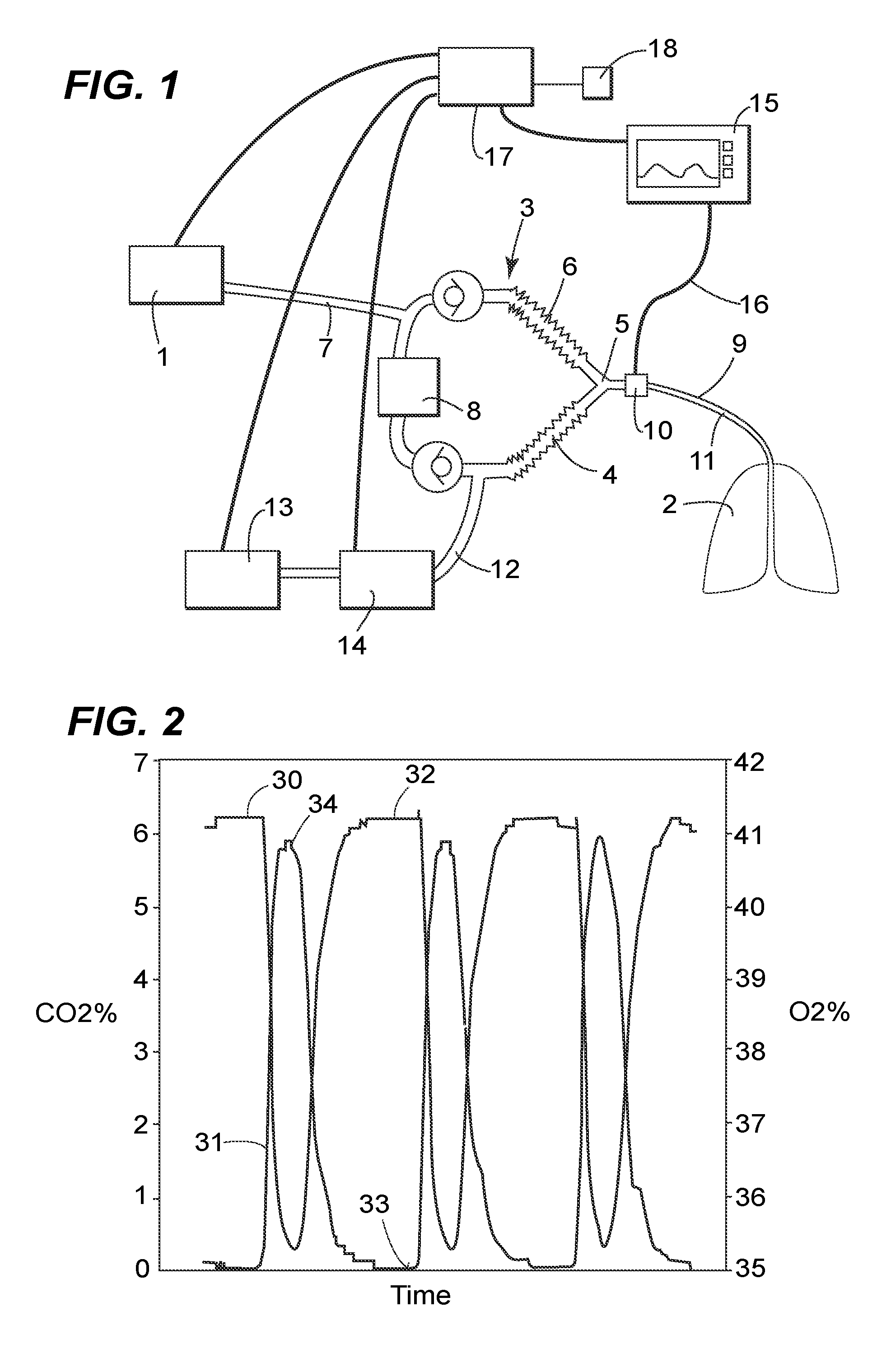 Inhalation anaesthesia delivery system and method