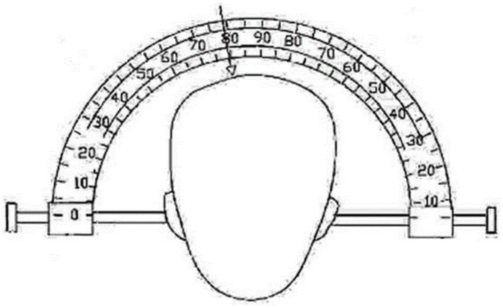 Lateral ventricle frontal angle puncture guiding device