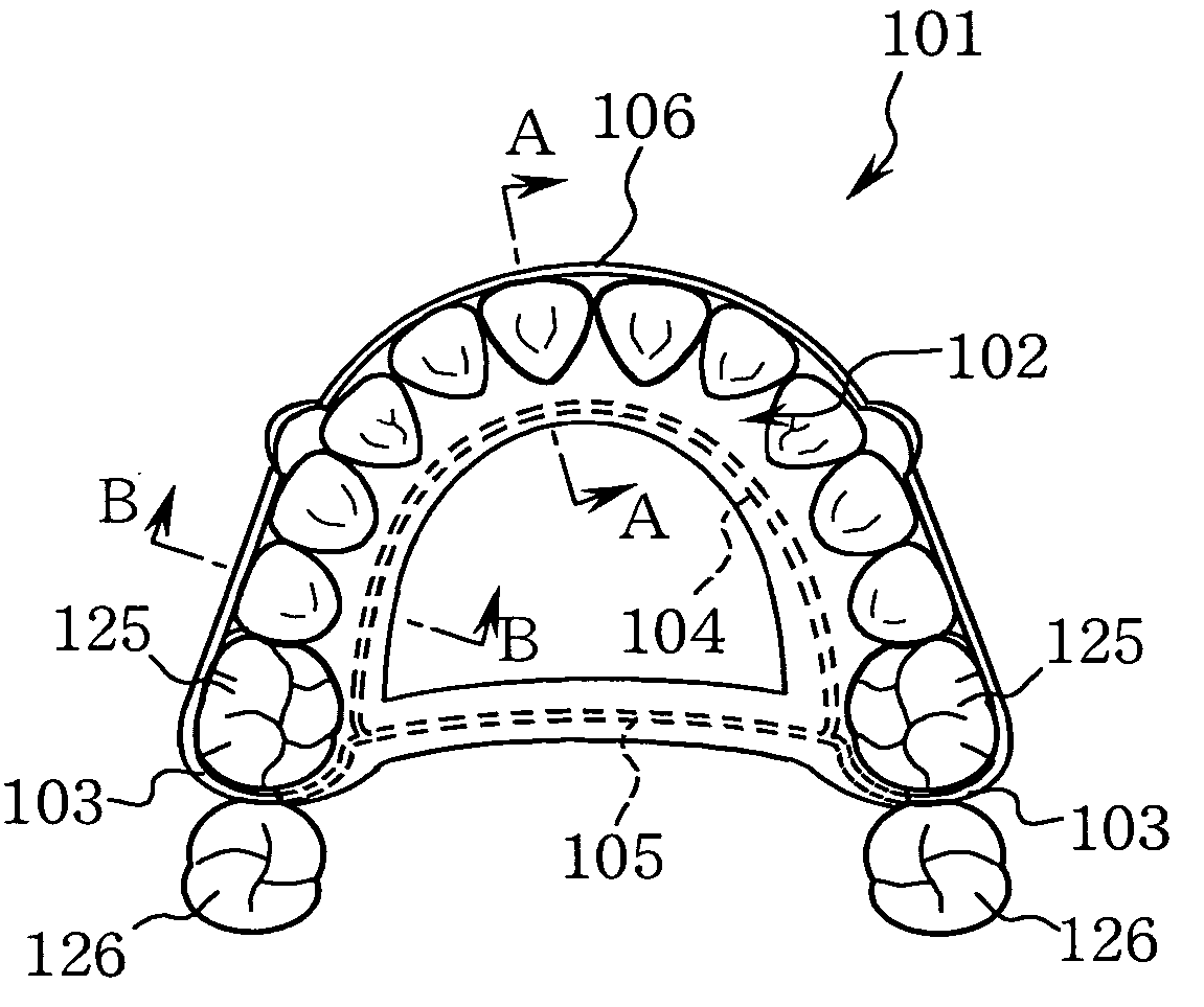 Orthodontic retainer